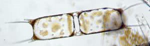 Biddulphia diatom splitting in two